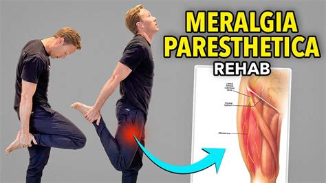 pelvic compression test for meralgia paresthetica|best exercise for meralgia paresthetica.